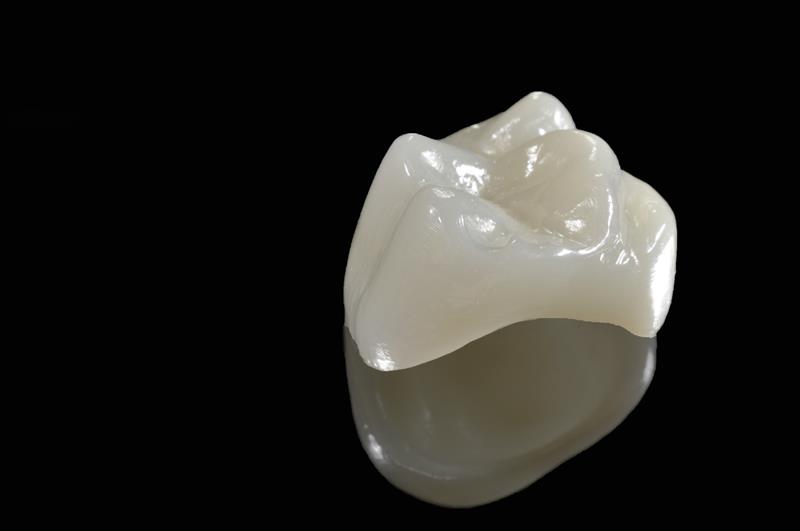 Porcelain Crowns In side wellness Center on Thunderchild First Nation